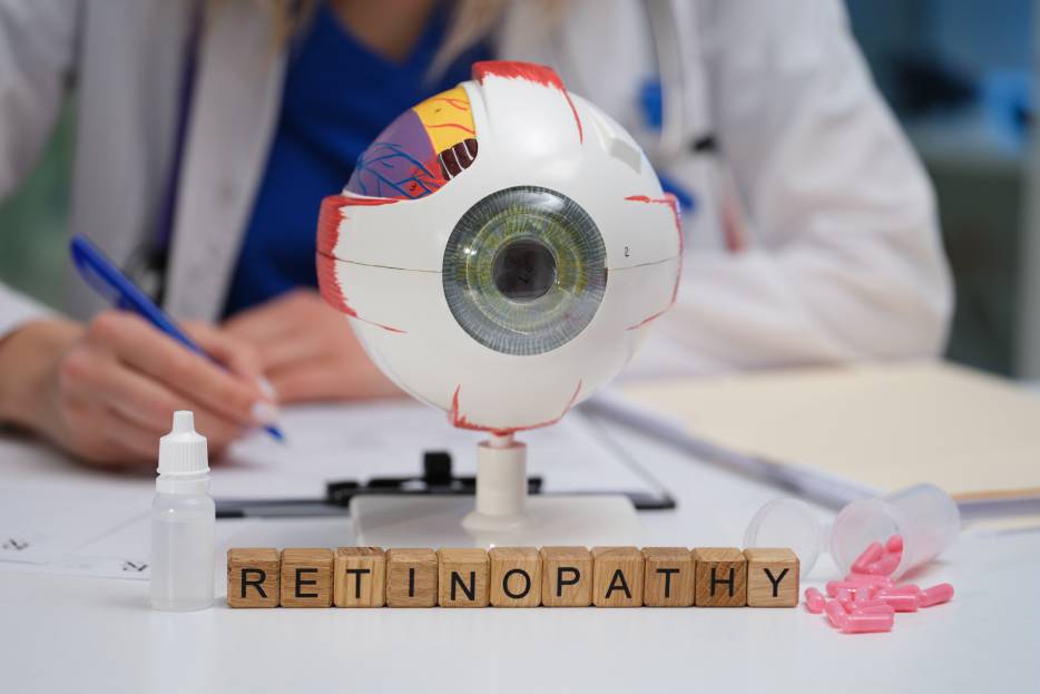 oftalmólogo en consultorio frente a un modelo de ojo con retinopatía diabética